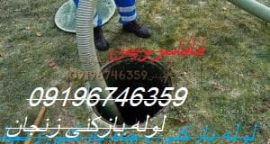 لوله بازکنی زنجان